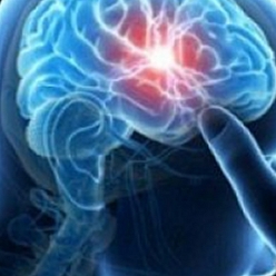 دکتر غلامحسین بهروز متخصص مغز و اعصاب