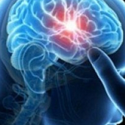 دکتر محمد علی ملک نژاد متخصص مغز و اعصاب