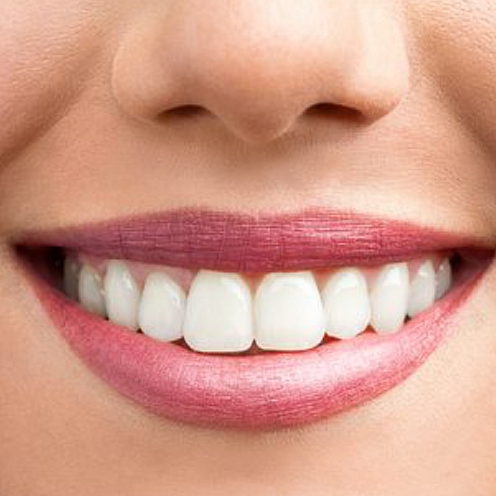 دندان هایی سفید و سالم با پرهیز از چند خوراکی