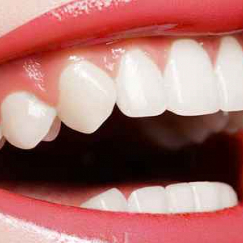 راه های ساده تقویت لثه ها