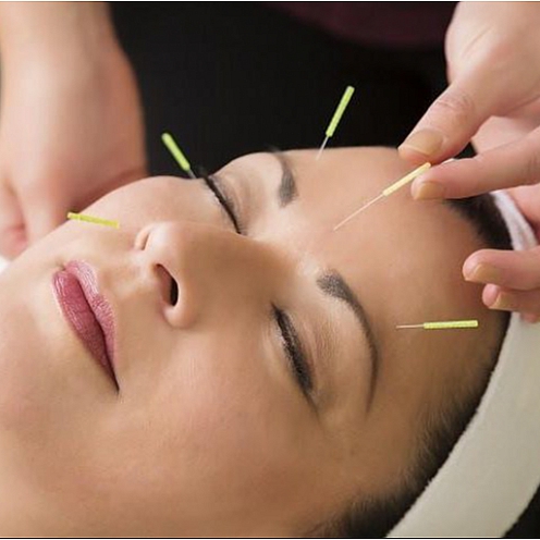 طب سوزنی چیست و برای کدام بیماری ها کاربرد دارد؟