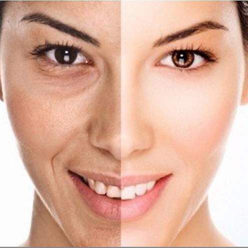 چین و چروک های پوست را با روش های طبیعی کاهش دهید